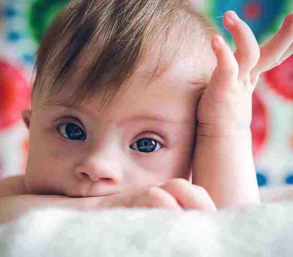 Παγκόσμια Ημέρα Ατόμων με Σύνδρομο Down 21 Μαρτίου 2025