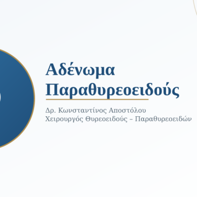 Αδένωμα Παραθυρεοειδούς: Τι Είναι, Πώς Εκδηλώνεται και Πώς Αντιμετωπίζεται 2 Αδένωμα Παραθυρεοειδούς: Τι Είναι, Πώς Εκδηλώνεται και Πώς Αντιμετωπίζεται