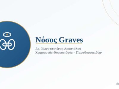 Νόσος Graves: Τι Είναι, Πώς Εκδηλώνεται και Ποιες Είναι οι Θεραπευτικές Επιλογές 14 Νόσος Graves: Τι Είναι, Πώς Εκδηλώνεται και Ποιες Είναι οι Θεραπευτικές Επιλογές