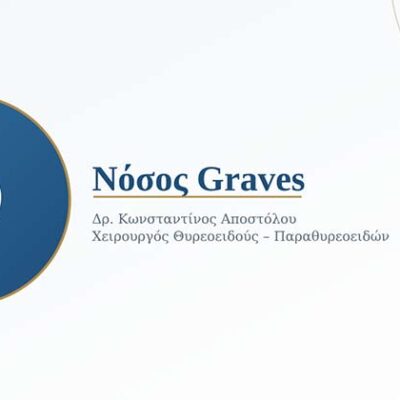 Νόσος Graves: Τι Είναι, Πώς Εκδηλώνεται και Ποιες Είναι οι Θεραπευτικές Επιλογές